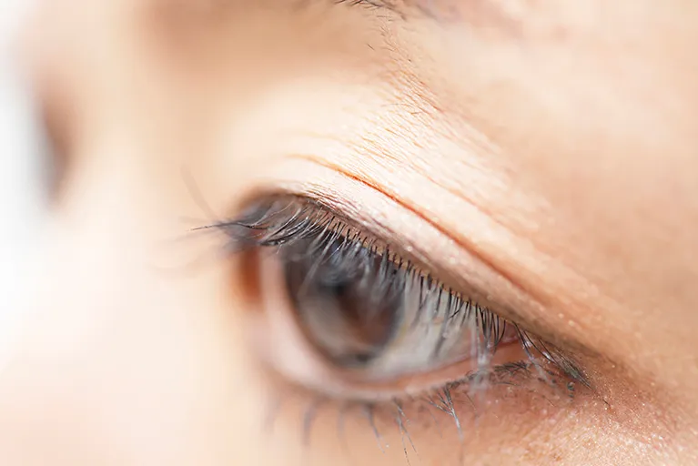 3.将来的な目の治療に影響がでにくい